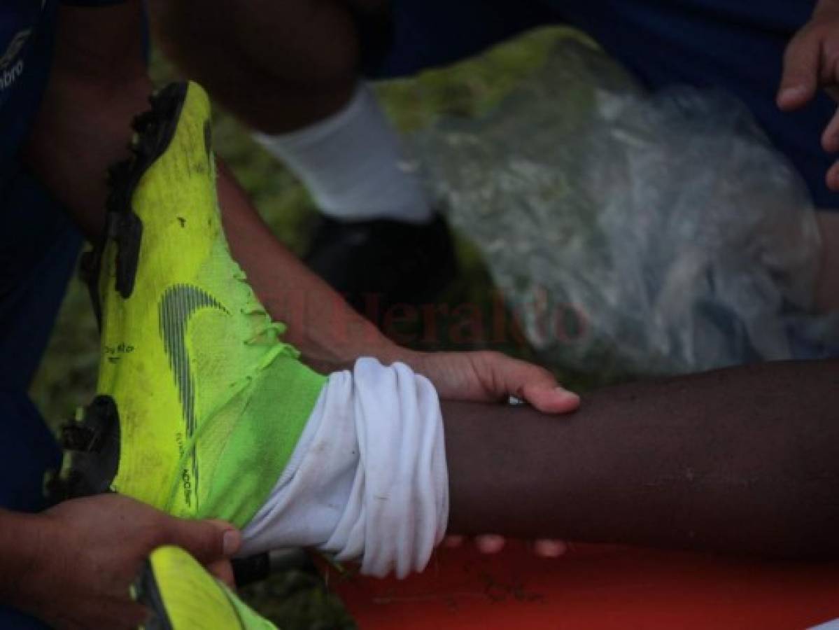 El jugador resultó lesionado en el juego ante el Vida. Foto Grupo OPSA