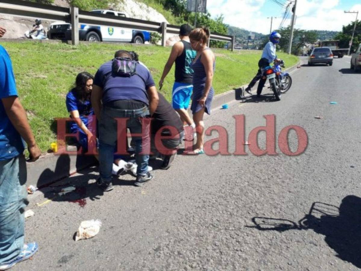 Mujer casi pierde la vida al ser atropellada en anillo periférico de Tegucigalpa