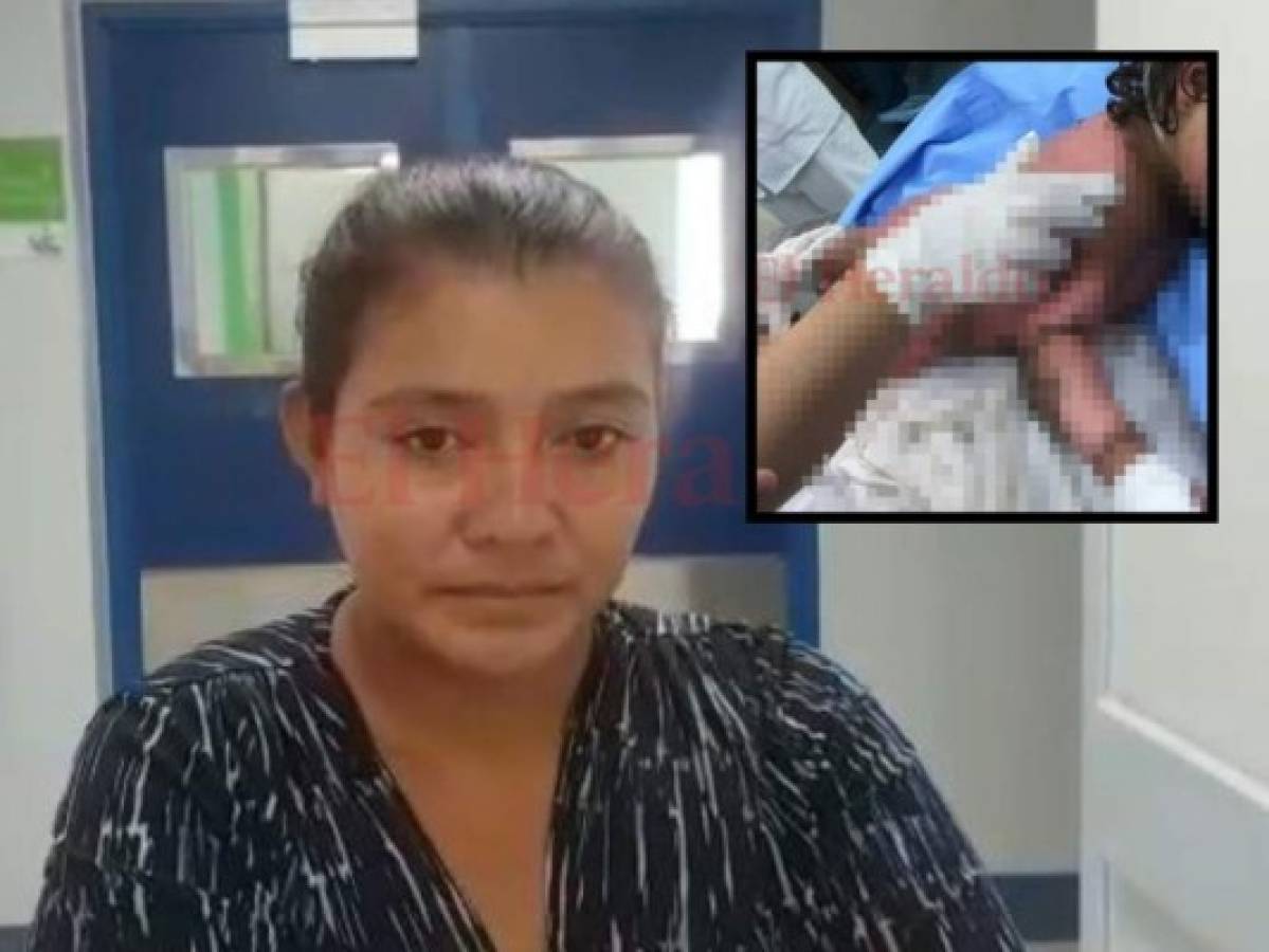 Madre de niña quemada al caer en olla de chilate: Solo es por ratitos que habla y lo único que pide es agua