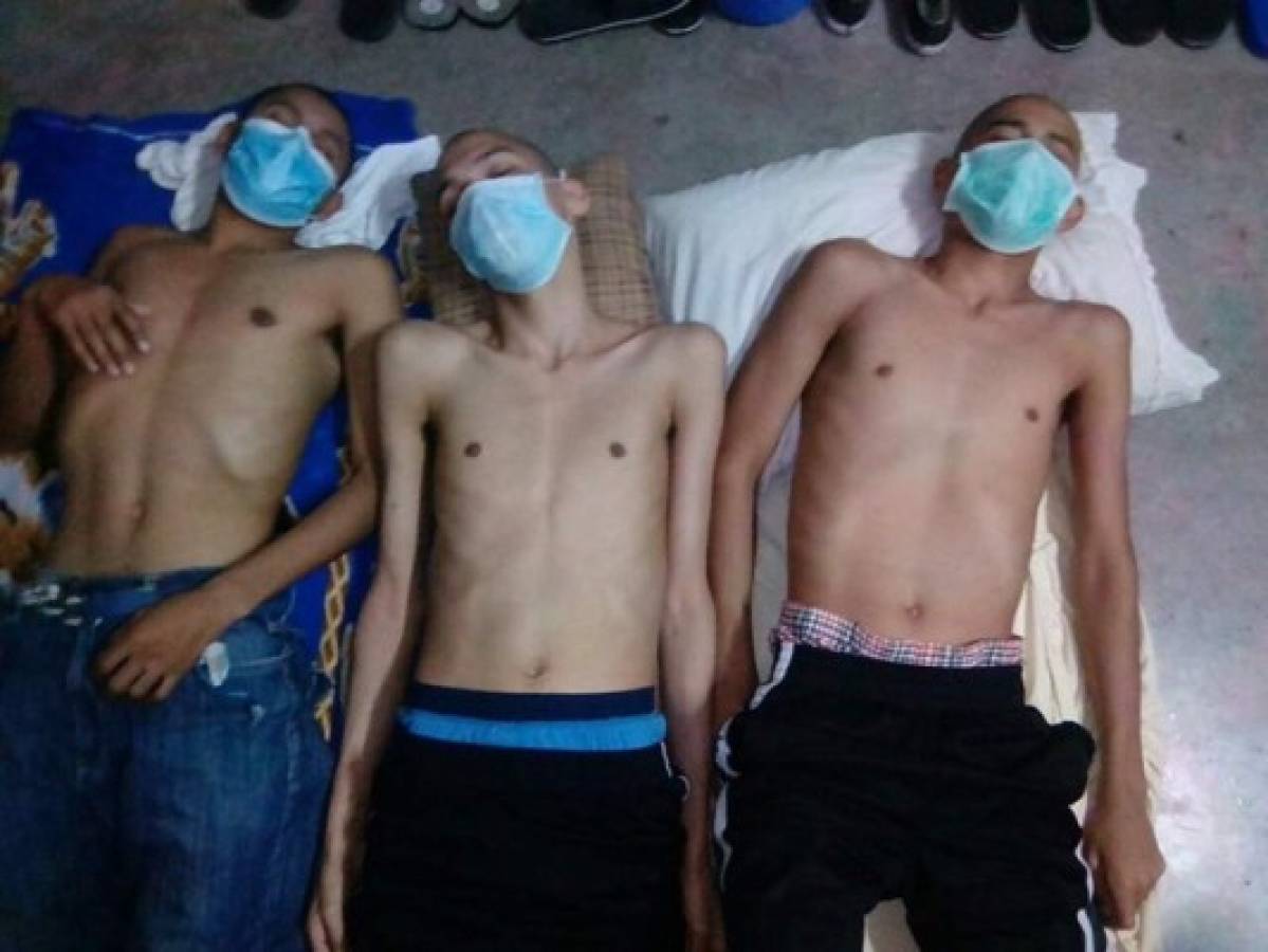 Brote de tuberculosis en cárceles de Honduras preocupa a la población