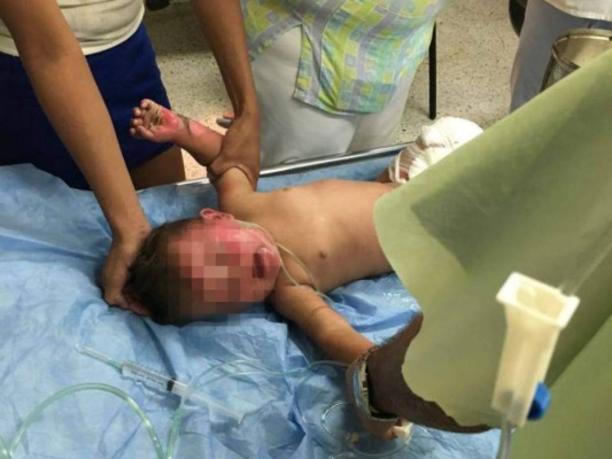 Bebé de nueve meses es rescatada de incendio en El Progreso