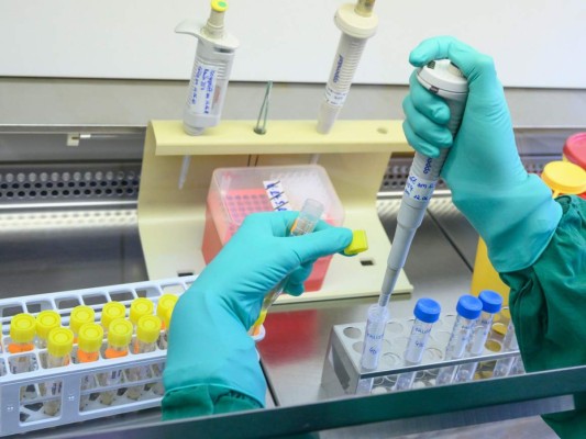 Científicos trabajan en ocho proyectos de vacuna contra coronavirus