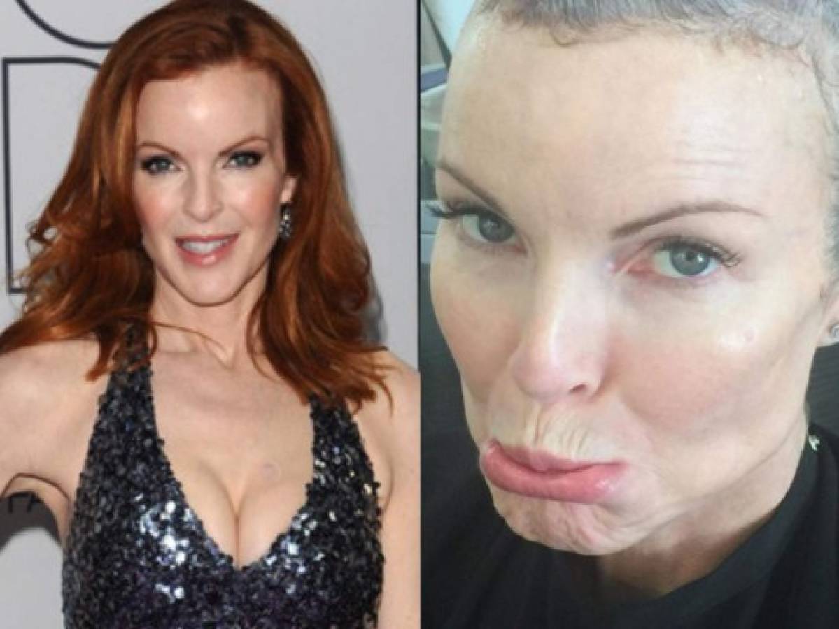 Marcia Cross, actriz de Desperate Housewives, revela que padeció cáncer