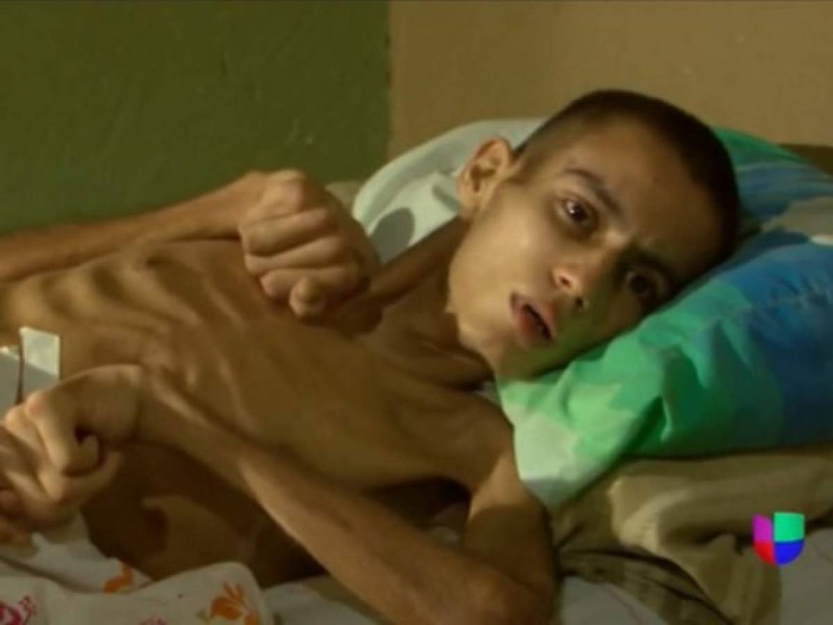 Migrante hondureño queda postrado en una cama tras sufrir golpiza