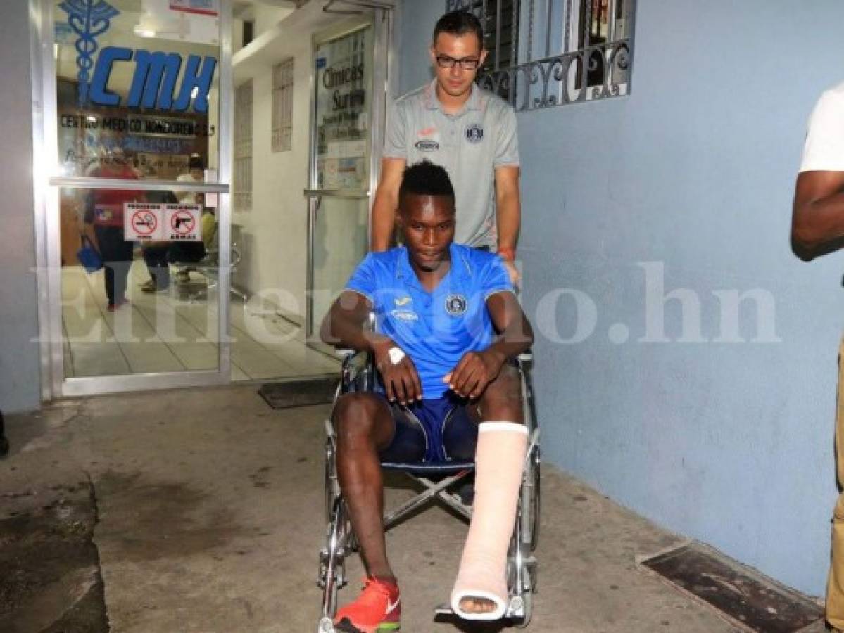 Rubilio Castillo: 'Mi lesión fue espantosa'