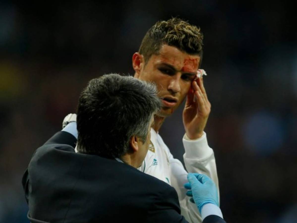 Cristiano Ronaldo recibe fuerte golpe tras anotar doblete ante La Coruña