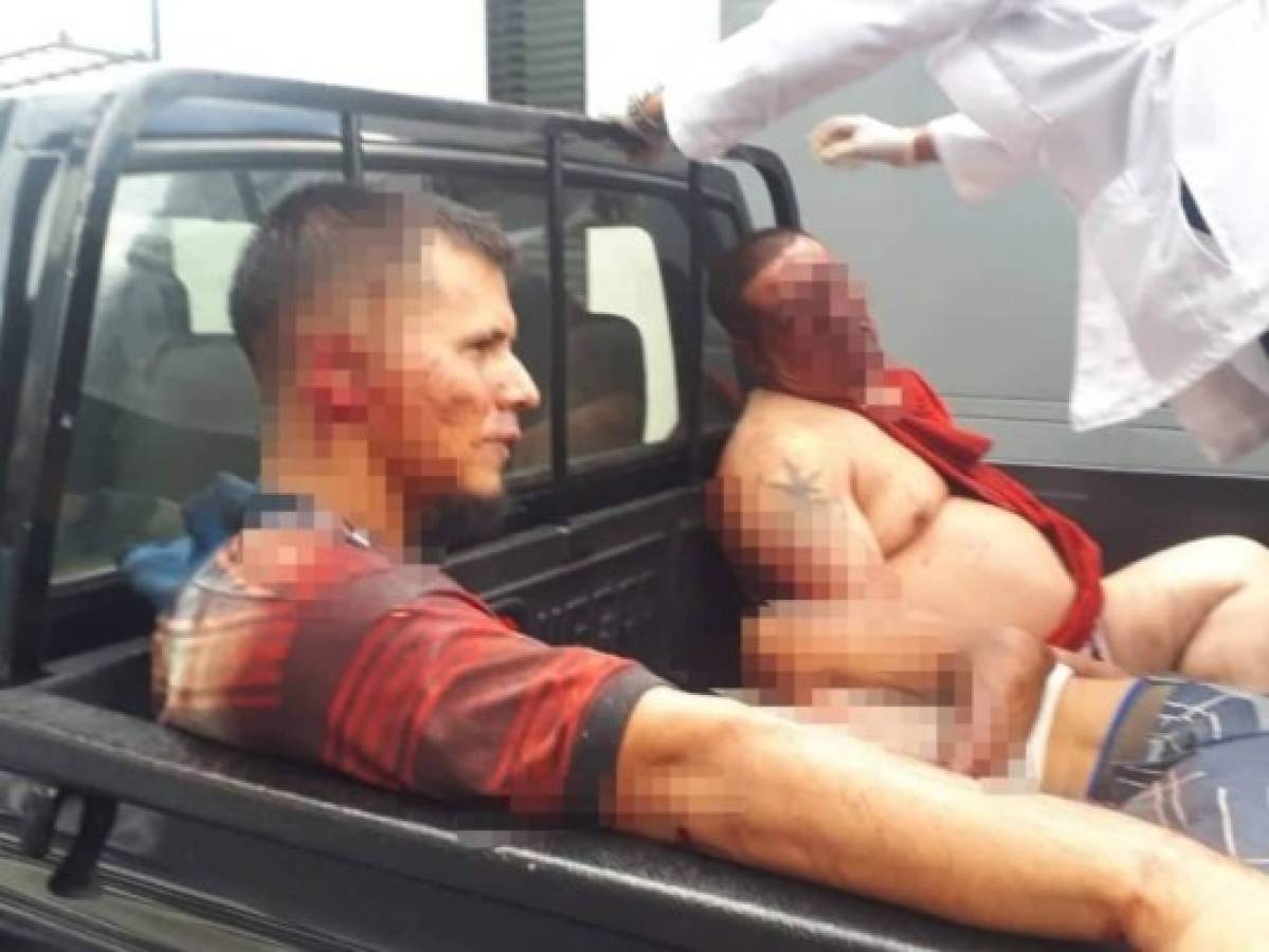 Listado de heridos en supuesto enfrentamiento en la Penitenciaría Nacional de Támara