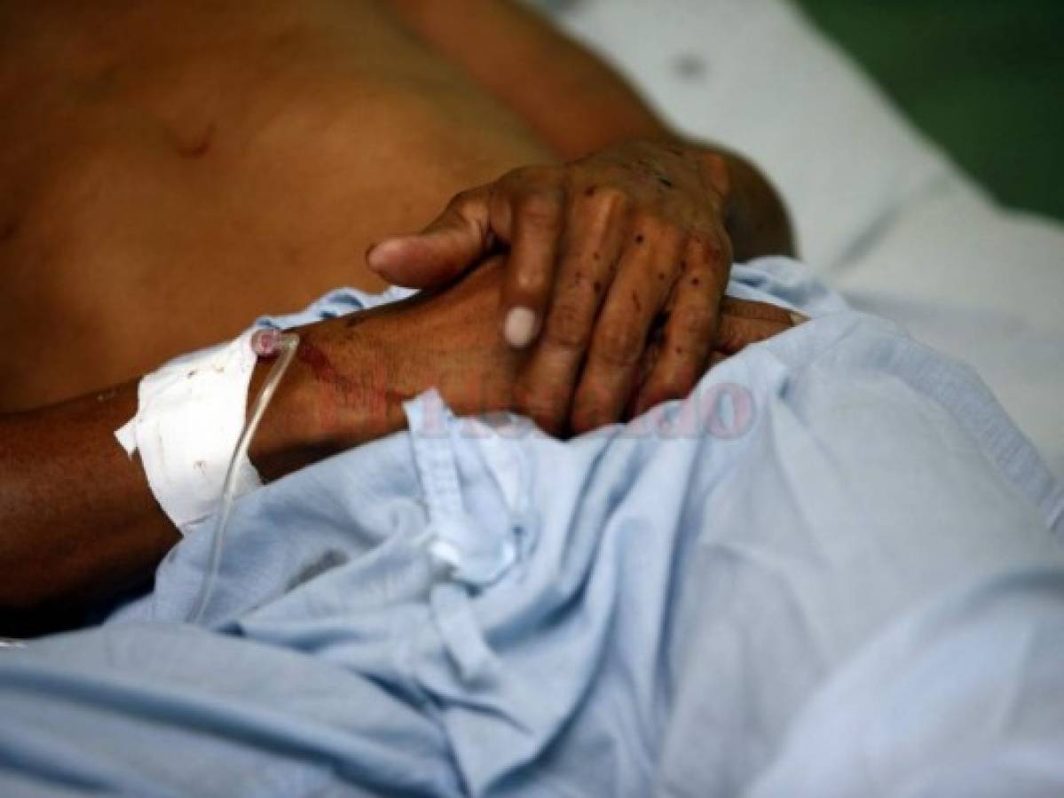 200 mil personas sufren epilepsia en Honduras