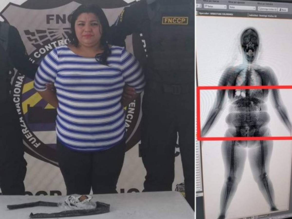 Mujer intentó introducir droga en una faja a 'El Pozo I' en Ilama, Santa Bárbara