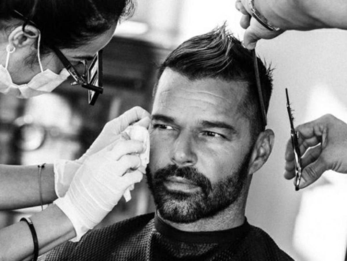Ricky Martin niega cirugía y revela qué le ocurrió a su rostro durante entrevista
