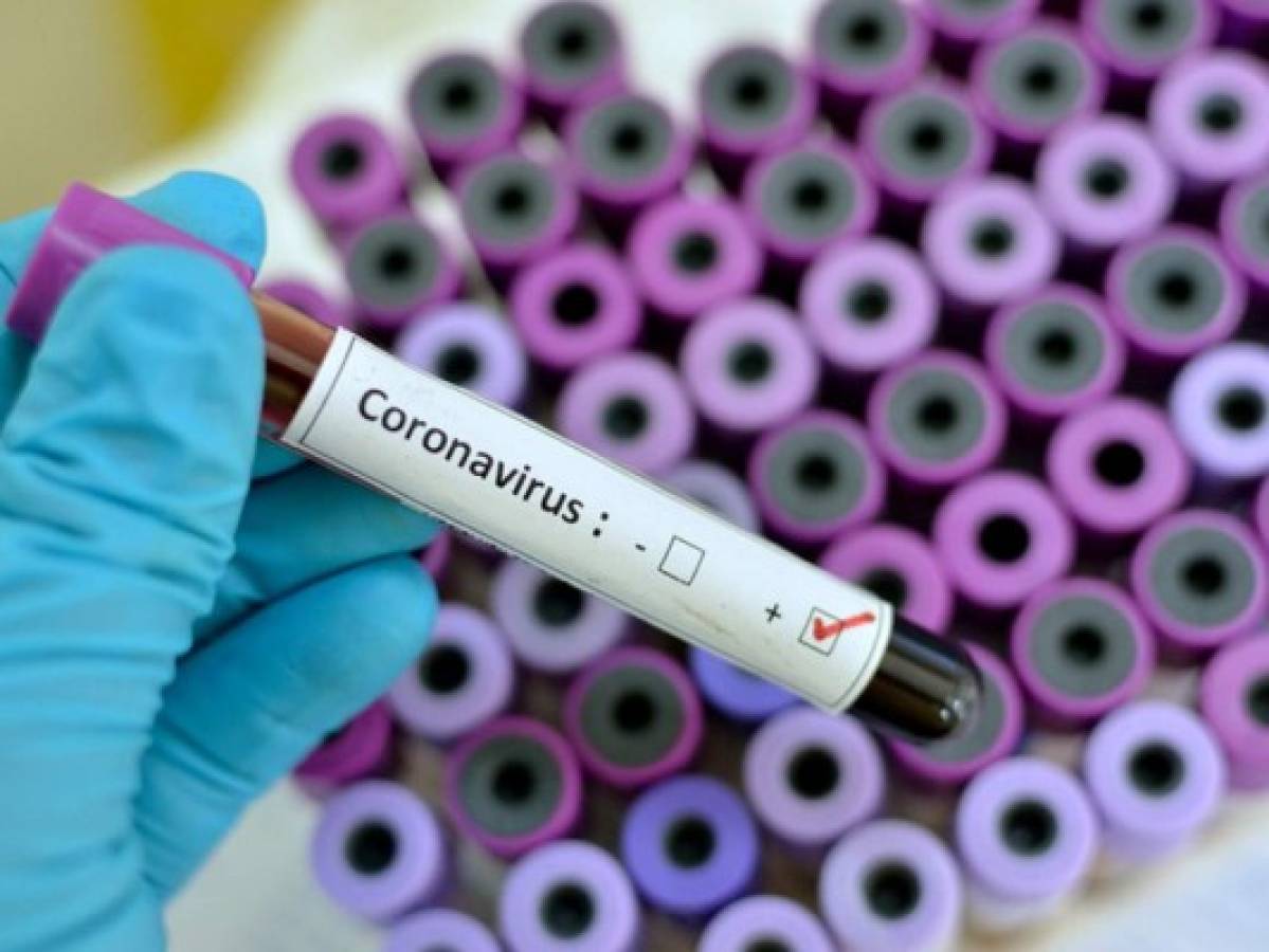 Coronavirus: a contrarreloj se hace la búsqueda de la vacuna