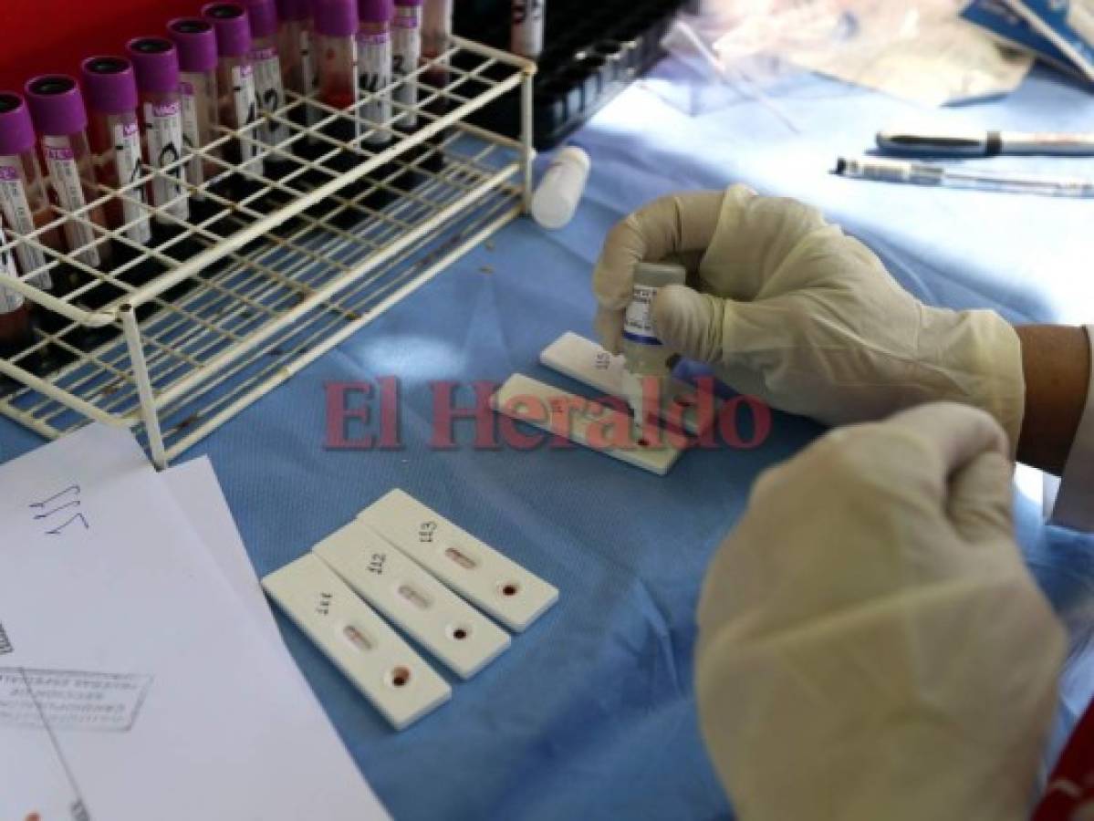 Cada 12 horas se infecta una persona con Virus de Inmunodeficiencia Humana (VIH) en Honduras