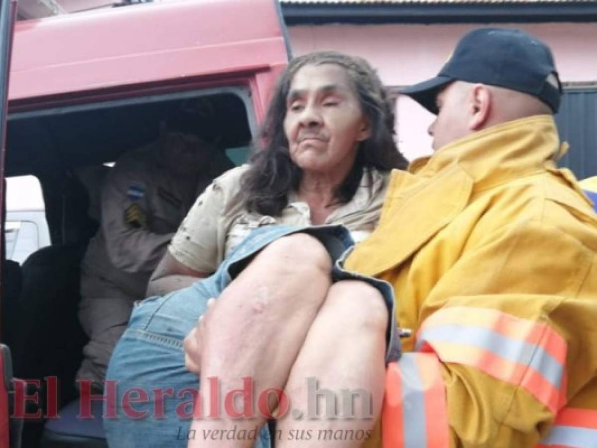 Barrio El Bosque: Mujer resulta con quemaduras tras incendio de su vivienda
