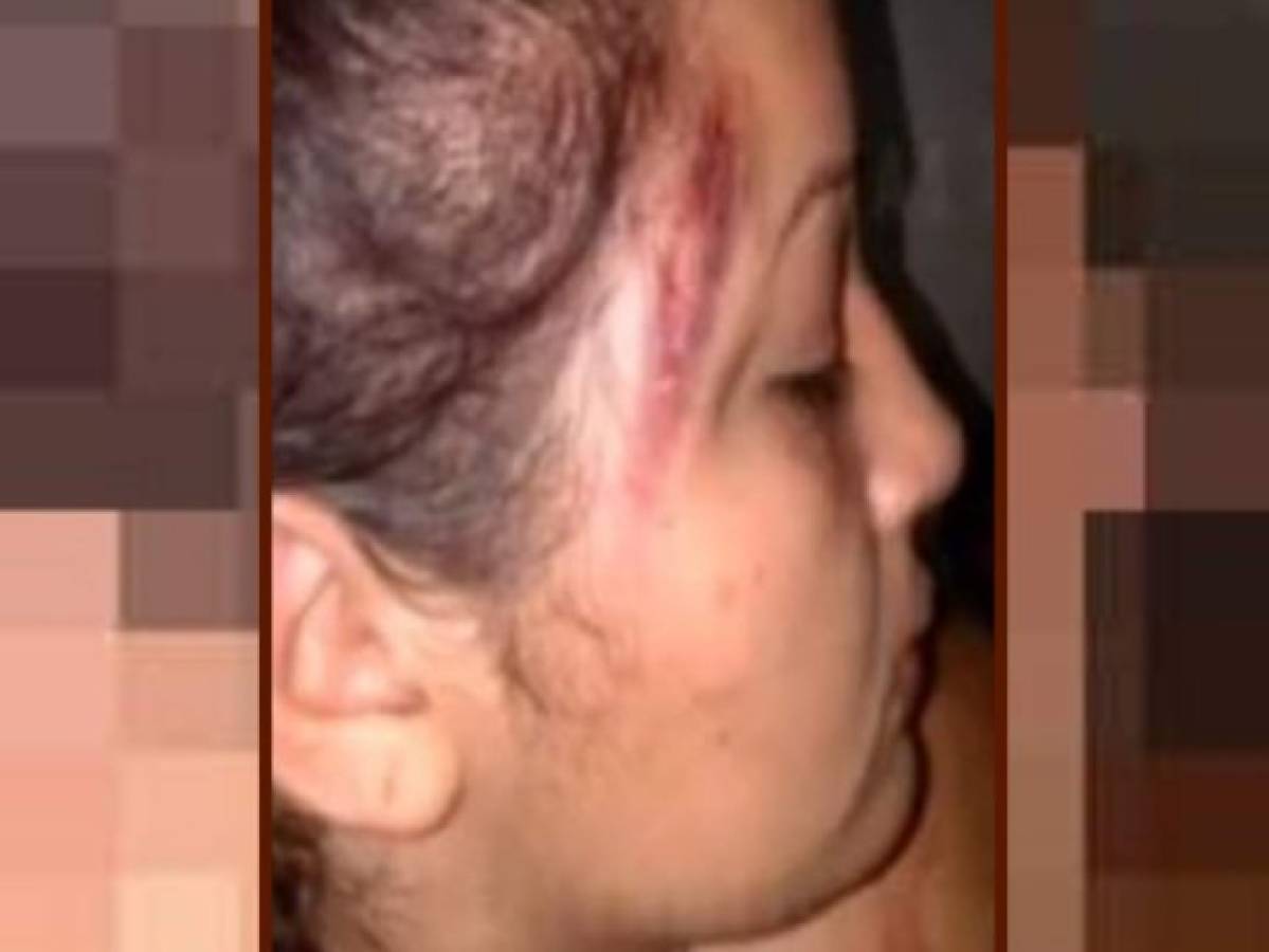 Reclusas se van a los golpes por una llamada telefónica en cárcel de mujeres de Támara 