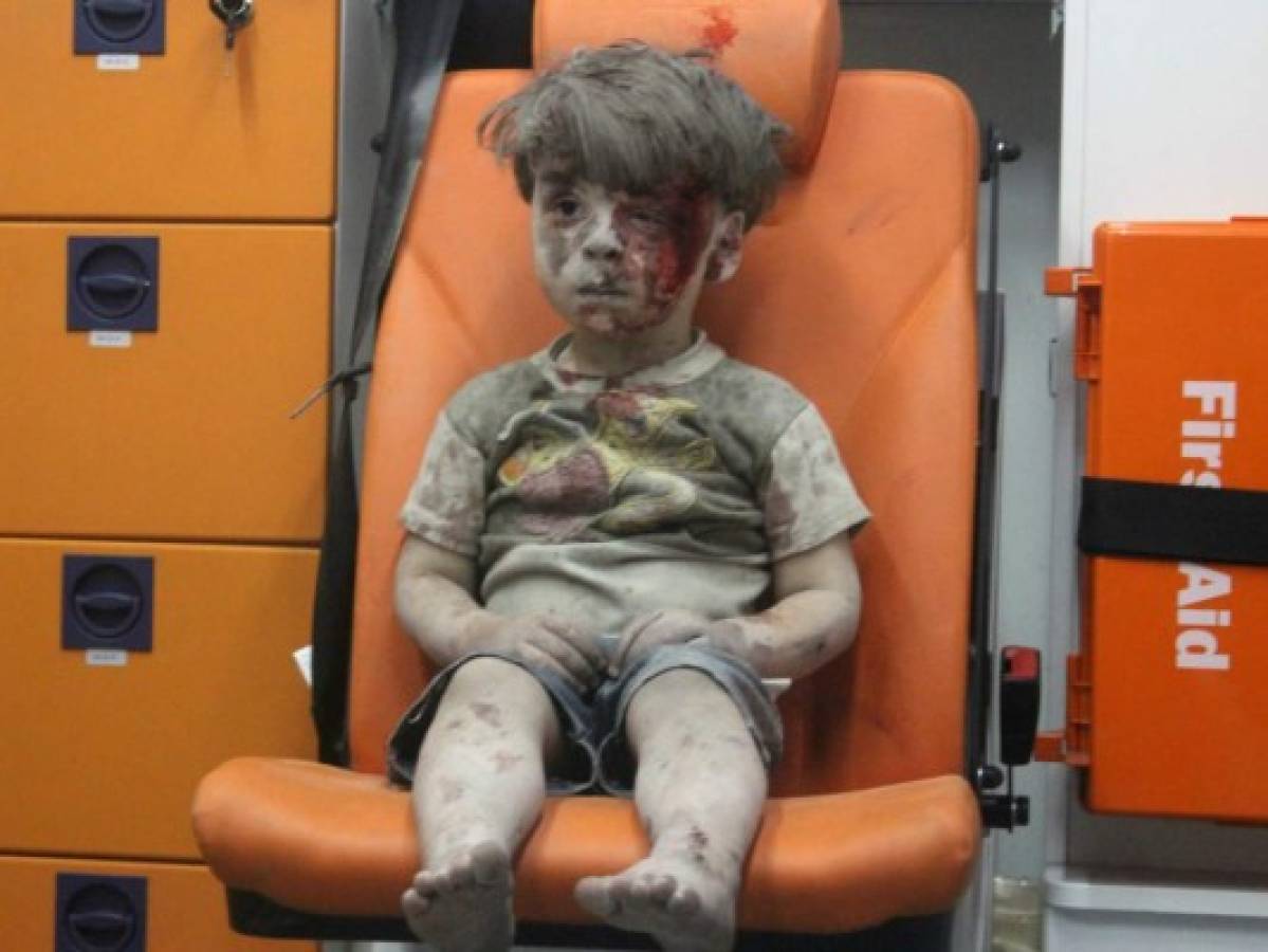 Bombardeo en Siria: Imágenes de un niño herido dan la vuelta al mundo