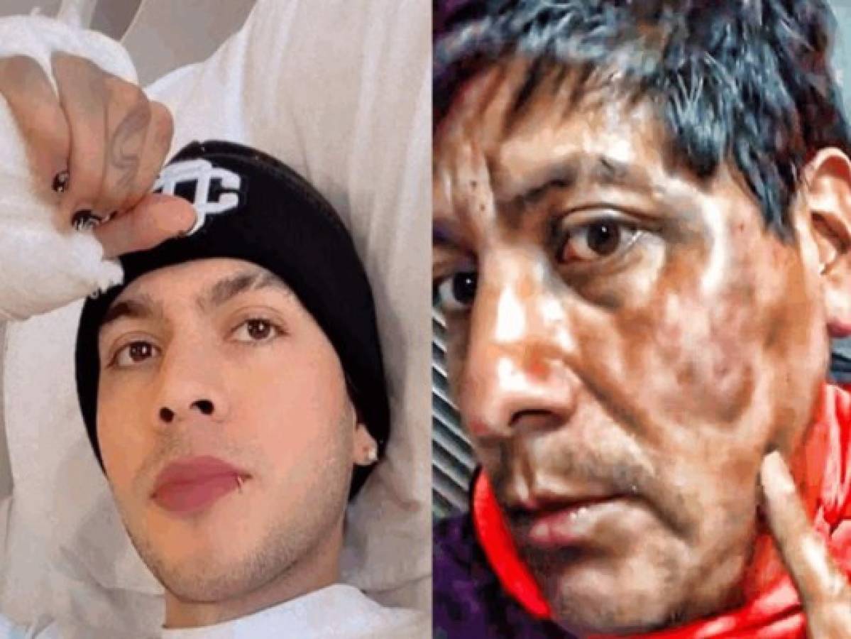 Juan de Dios Pantoja es hospitalizado tras golpear al 'acosador de Tiktok'