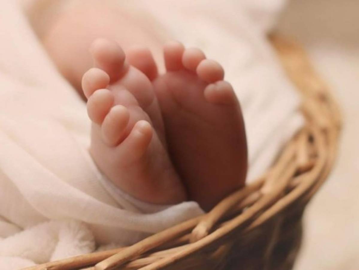 Nace bebé de 'tres cabezas' en la India