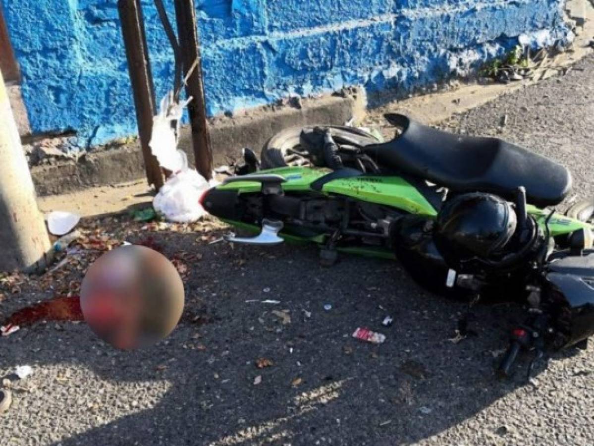 Motociclista pierde un pie al sufrir aparatoso accidente en San Pedro Sula