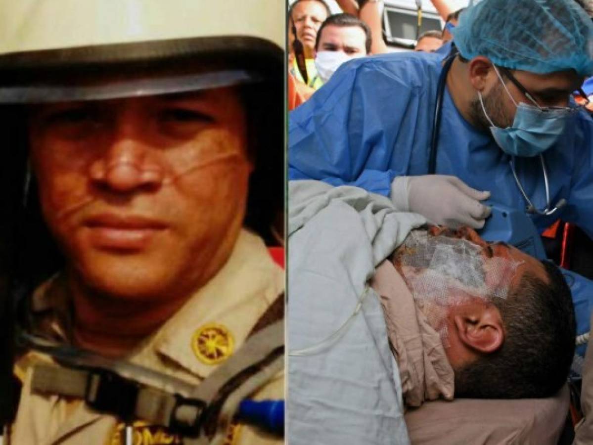 Muere Óscar Madrid, uno de los tres bomberos hondureños trasladados a México