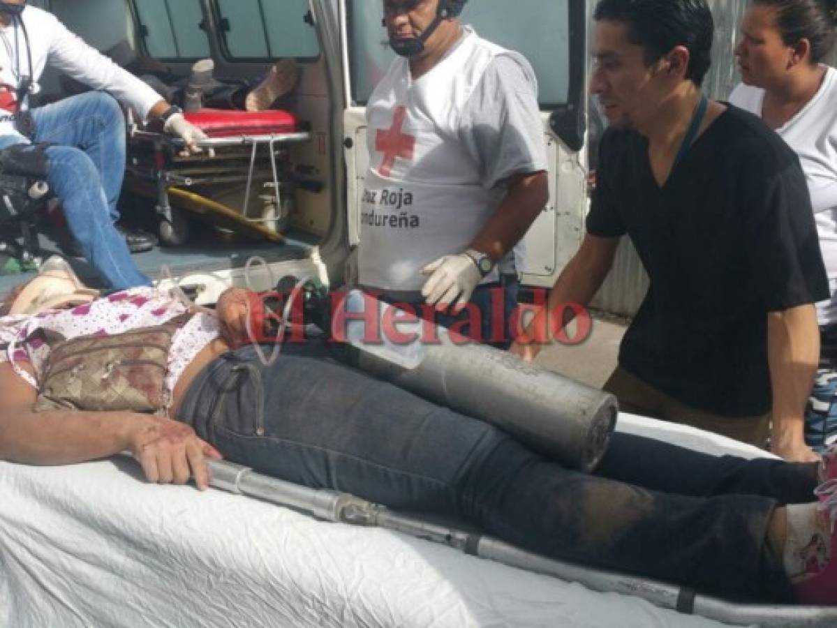 Un muerto y varios heridos deja accidente de bus en la carretera al sur de Honduras