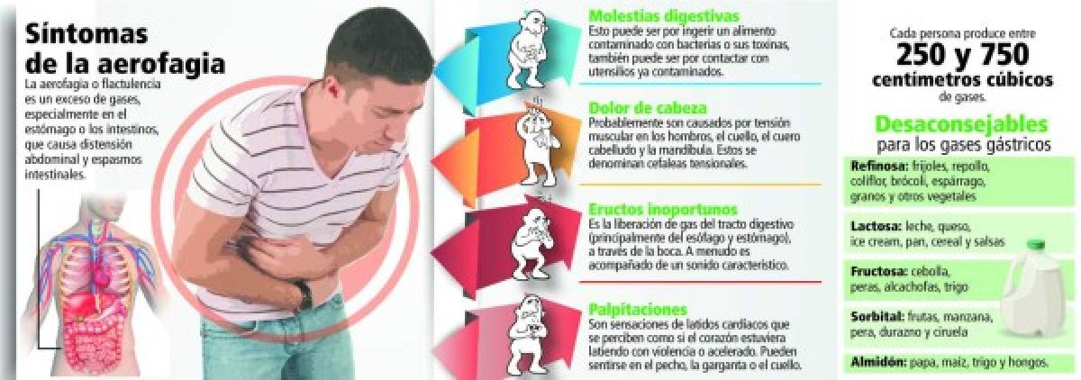 Síndrome del globo gástrico