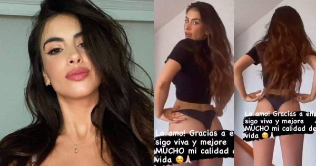 Las celebridades latinas que casi mueren por una mala cirugía estética