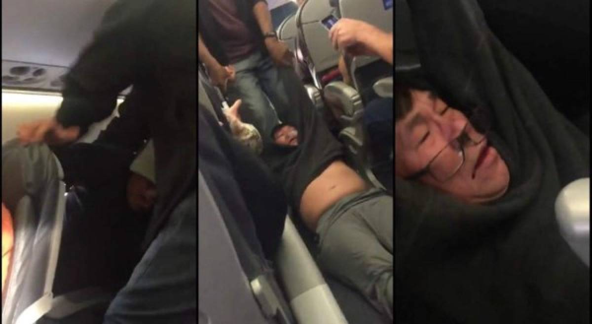 Pasajero expulsado de vuelo de United Airlines planea demandar, según abogados   