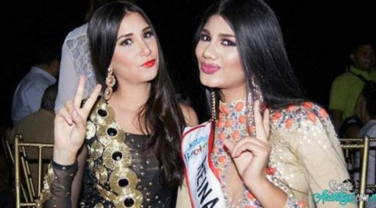 Los 'retoques' en el rostro de Sthefany Gutiérrez, Miss Venezuela, que revolucionan Internet