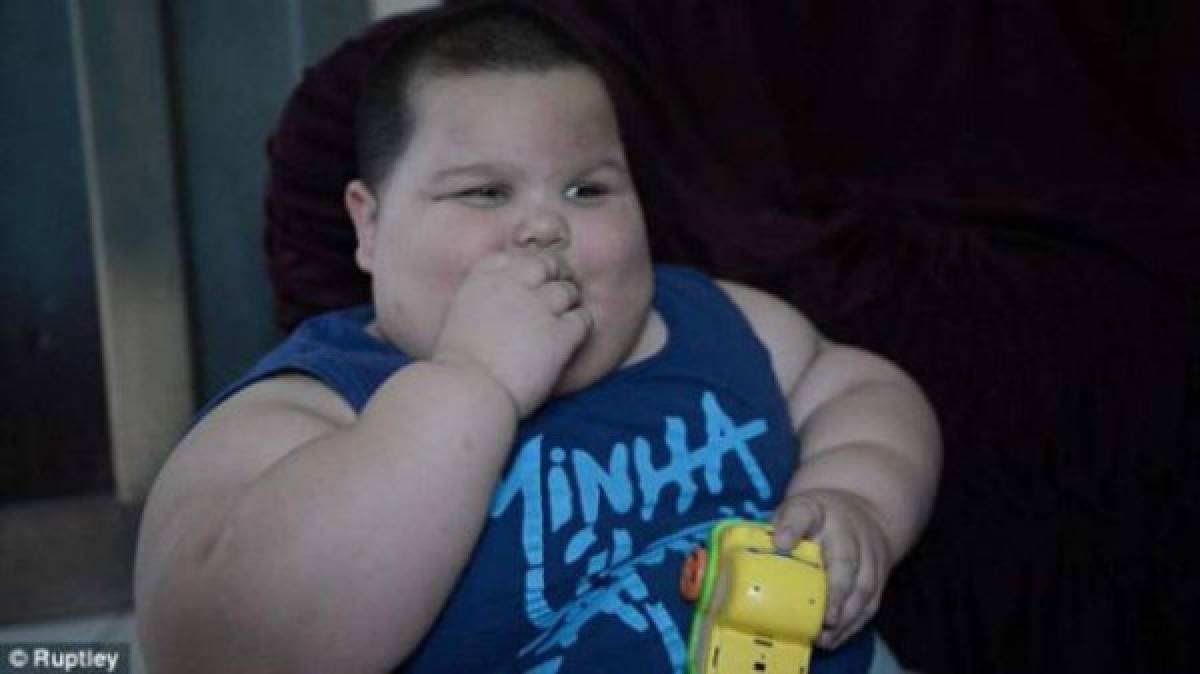 Niño de tres años pesa 70 kilos