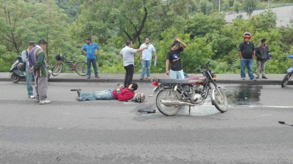 El joven que conducía una motocicleta tenía una fractura en su pie. Foto: Facebook/HEU