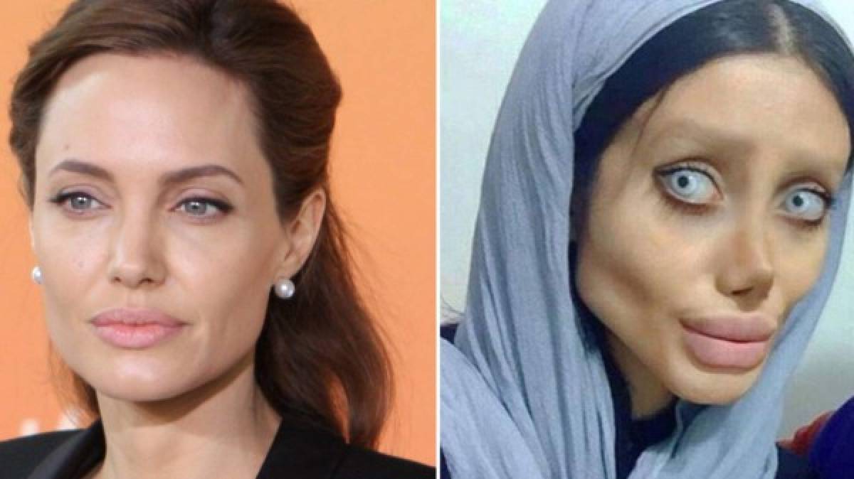 Joven de 19 años se somete a 50 cirugías para parecerse a Angelina Jolie