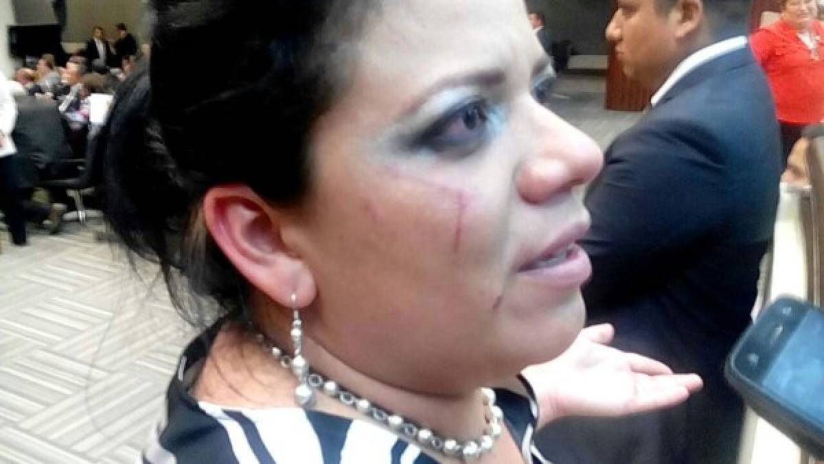 Diputada denuncia agresión de la esposa de David Romero