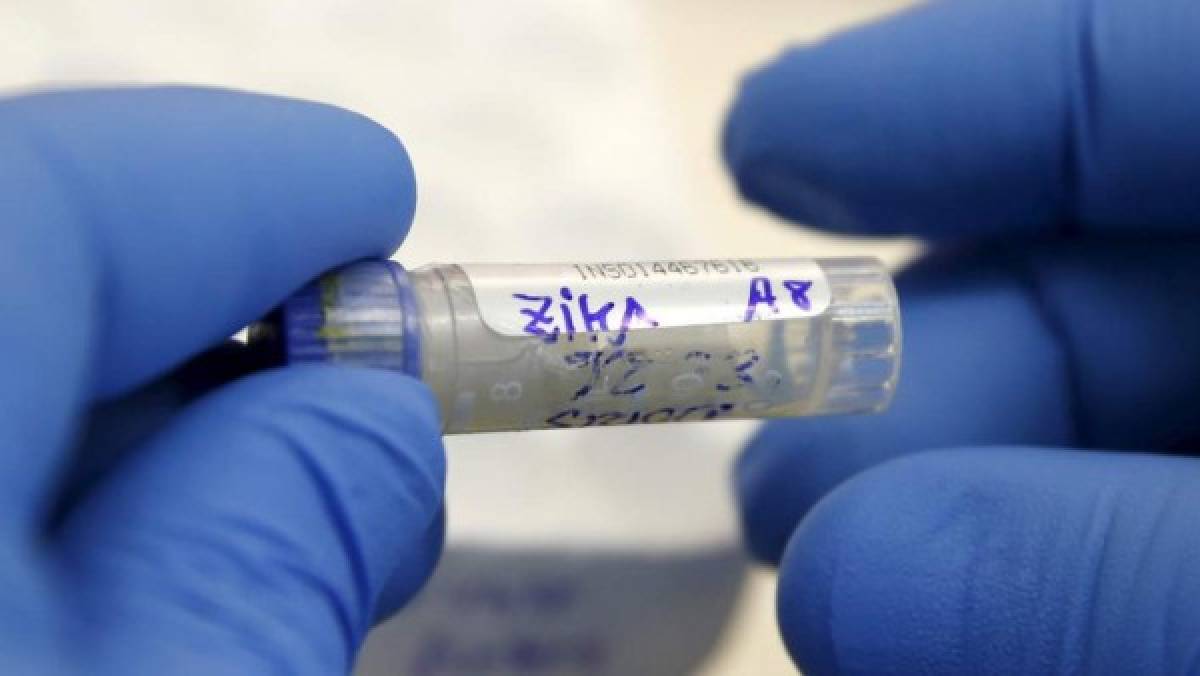 Chile confirma primer caso de zika autóctono, transmitido por vía sexual