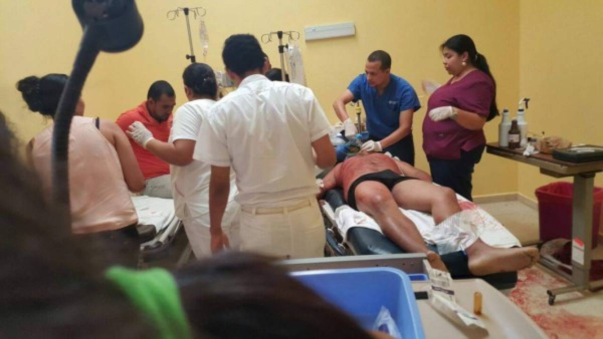Hombre muere en hospital de Catacamas tras recibir varios impactos de bala
