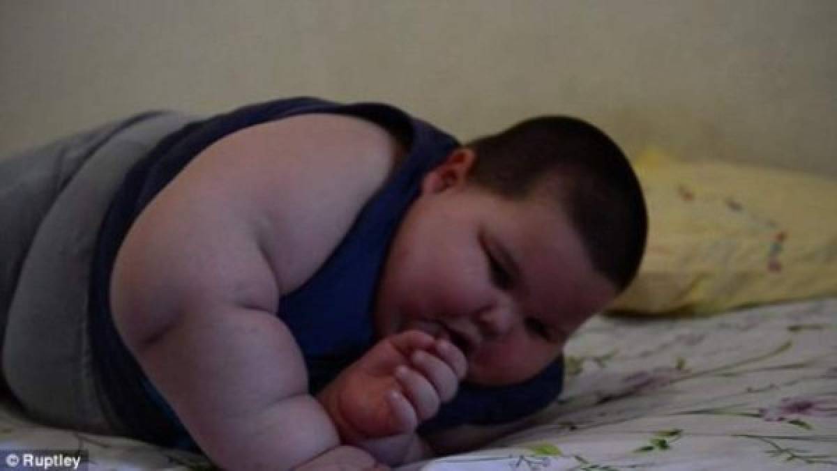 Niño de tres años pesa 70 kilos