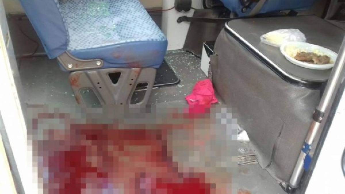 Tegucigalpa: Muere conductor de bus de El Sitio atacado mientras almorzaba
