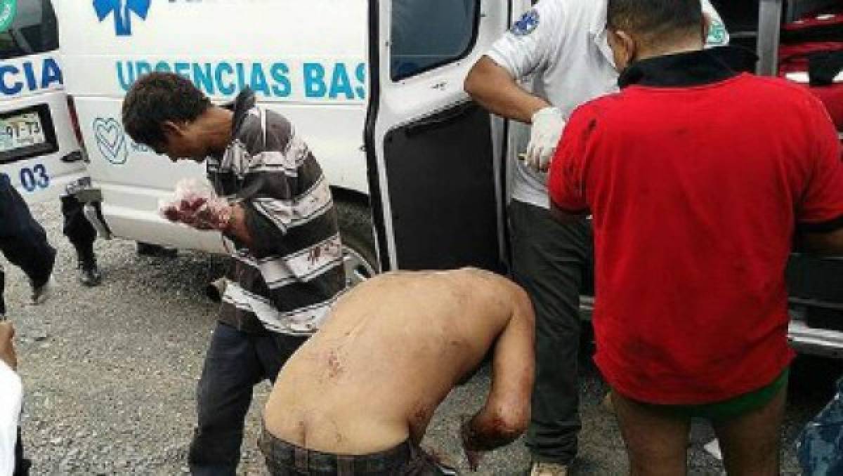 México: Amputan las manos de 7 supuestos ladrones y la noticia se viraliza en las redes