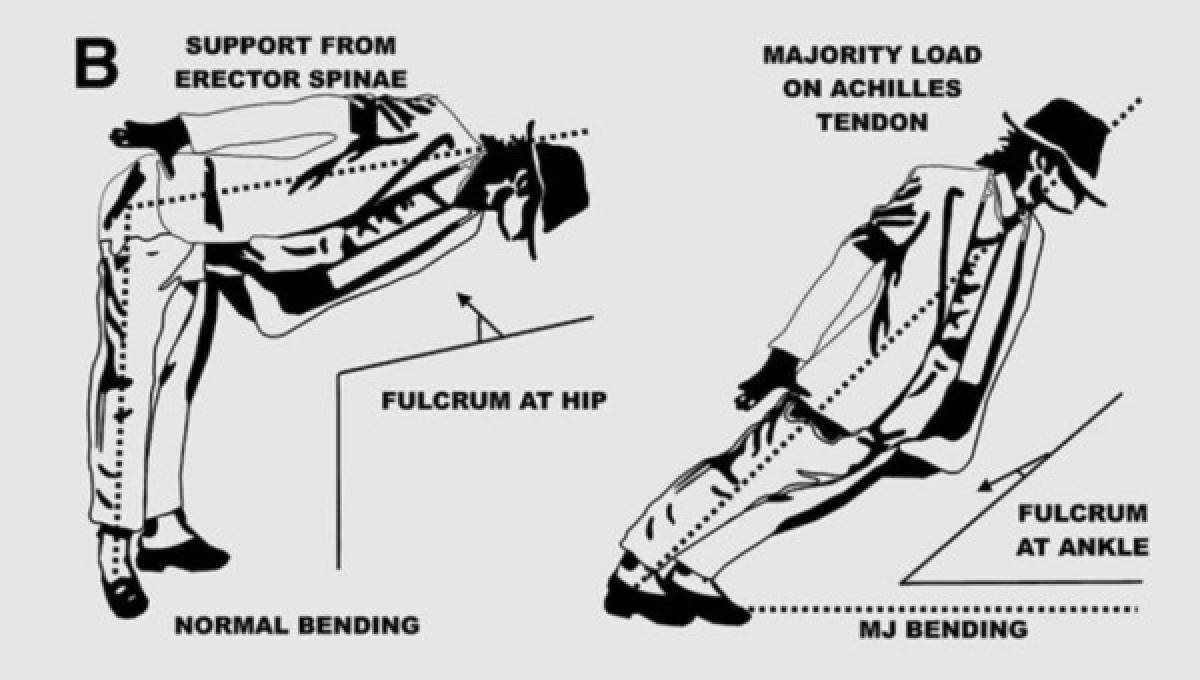 A la izquierda como se supone que el cuerpo se dobla. A la derecha cómo lo hizo Michael Jackson. Foto Journal of Neurosurgery