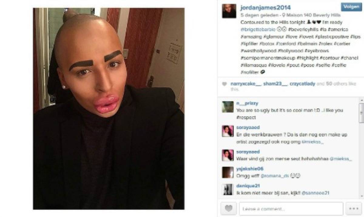 Un joven invirtió todo su dinero para parecerse a Kim Kardashian