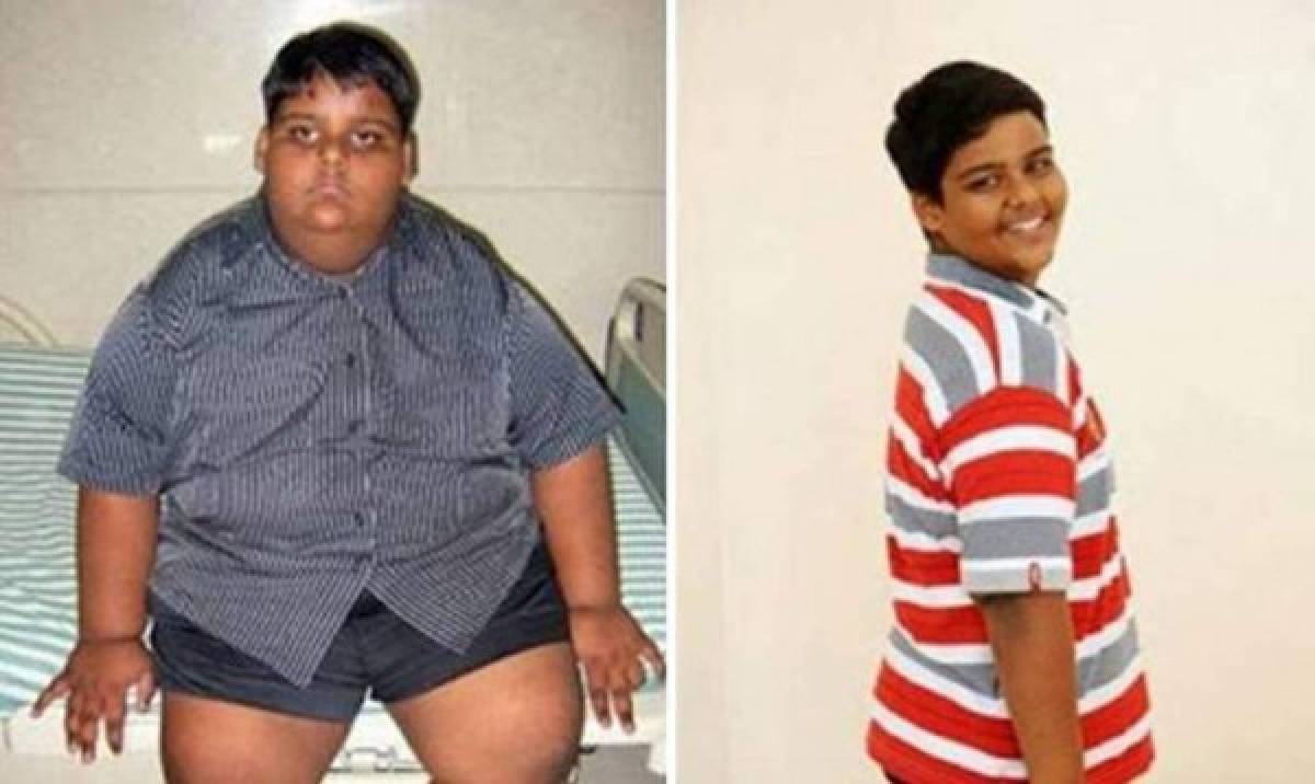 El chico se hizo adicto a la comida chatarra y estuvo con sobrepeso.