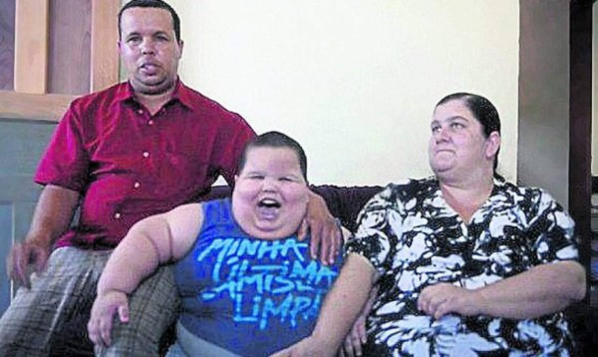 Niño de tres años pesa 70 kilos