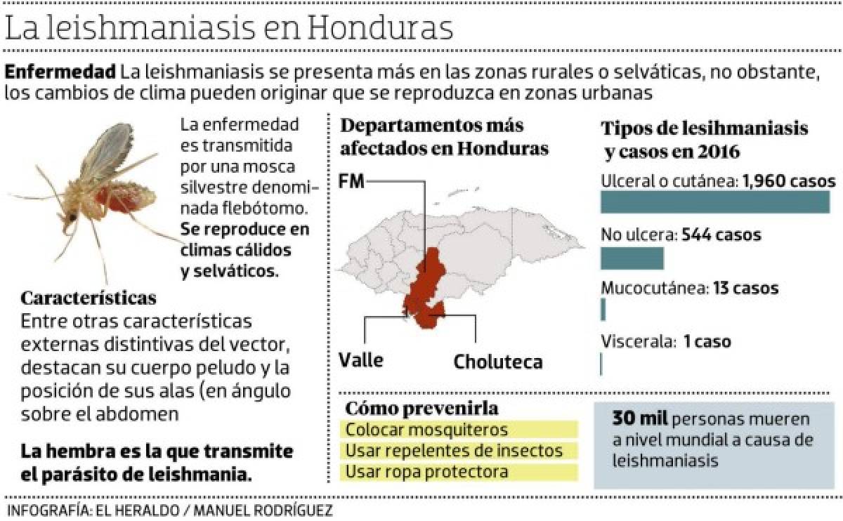 Salud refuerza vigilancia por leishmaniasis en Honduras