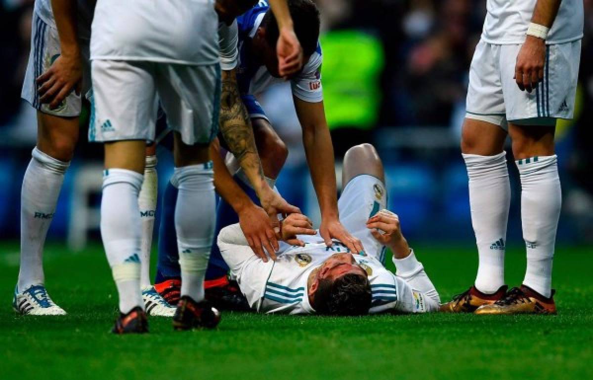 Cristiano Ronaldo recibe fuerte golpe tras anotar doblete ante La Coruña