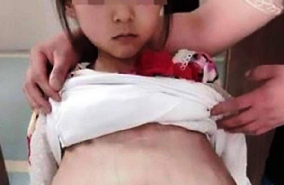 China: Niña de 12 años es llevada a un control prenatal por su esposo de 40 años