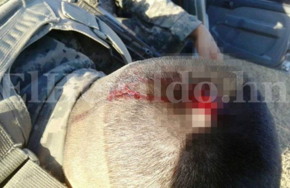 Uno de los militares recibió una pedrada que le provocó una herida en su cabeza cuando obreros lanzaron piedras (Foto: El Heraldo Honduras/ Noticias de Honduras)