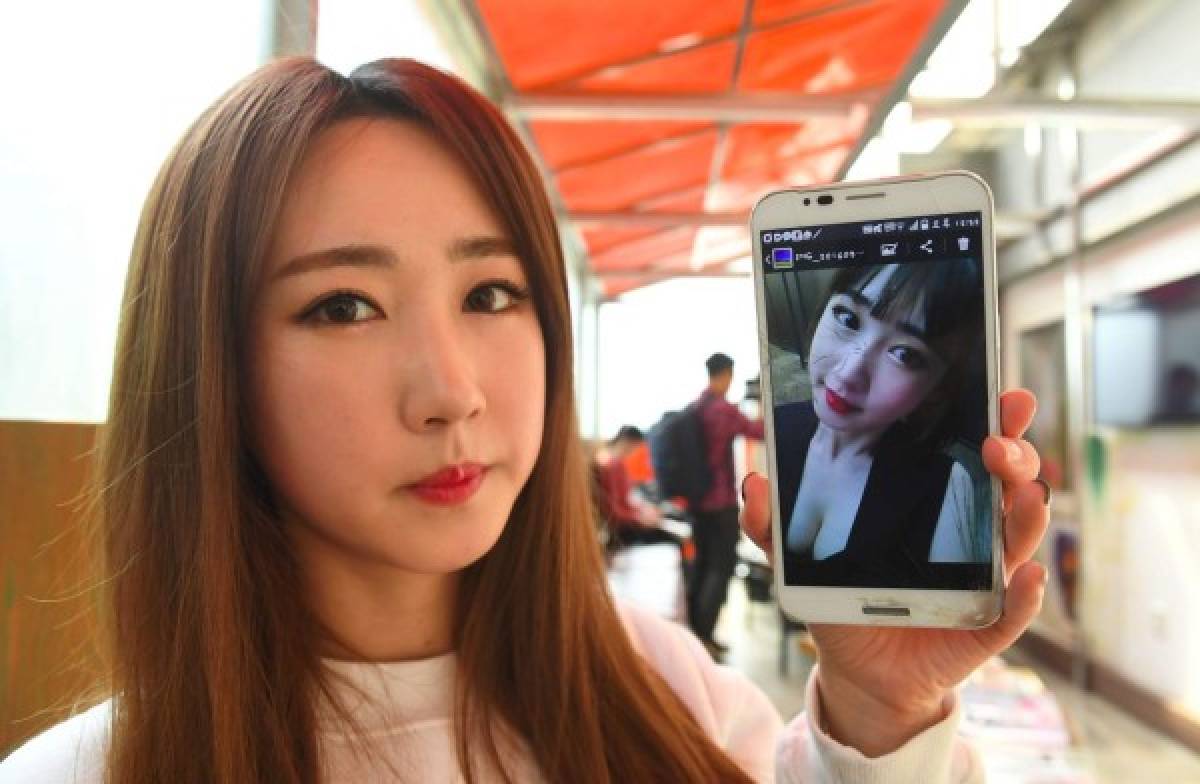 SixBomb: Las surcoreanas que muestran en video su paso por el quirófano