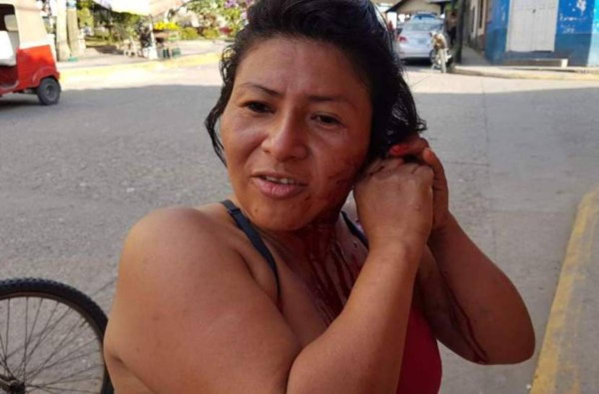 Mujer con problemas mentales se arranca la oreja 'al escuchar voces' en La Entrada, Copán