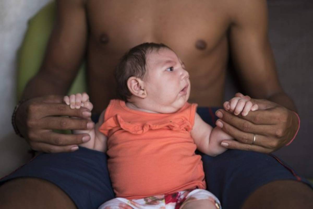 Suben casos de microcefalia que Brasil liga a brote de zika  