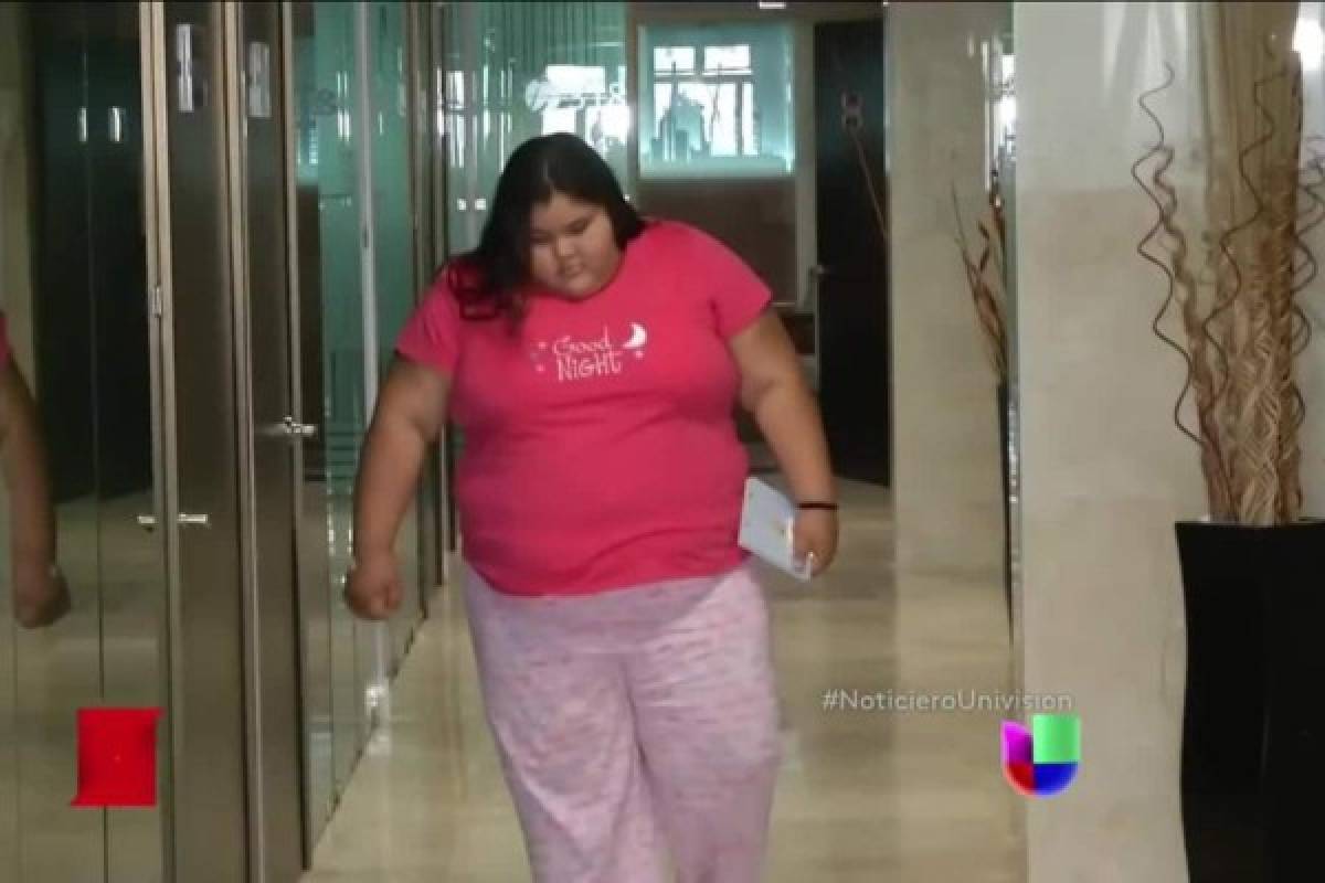 La adolescente mexicana más obesa del mundo bajó 90 kilos en menos de un año