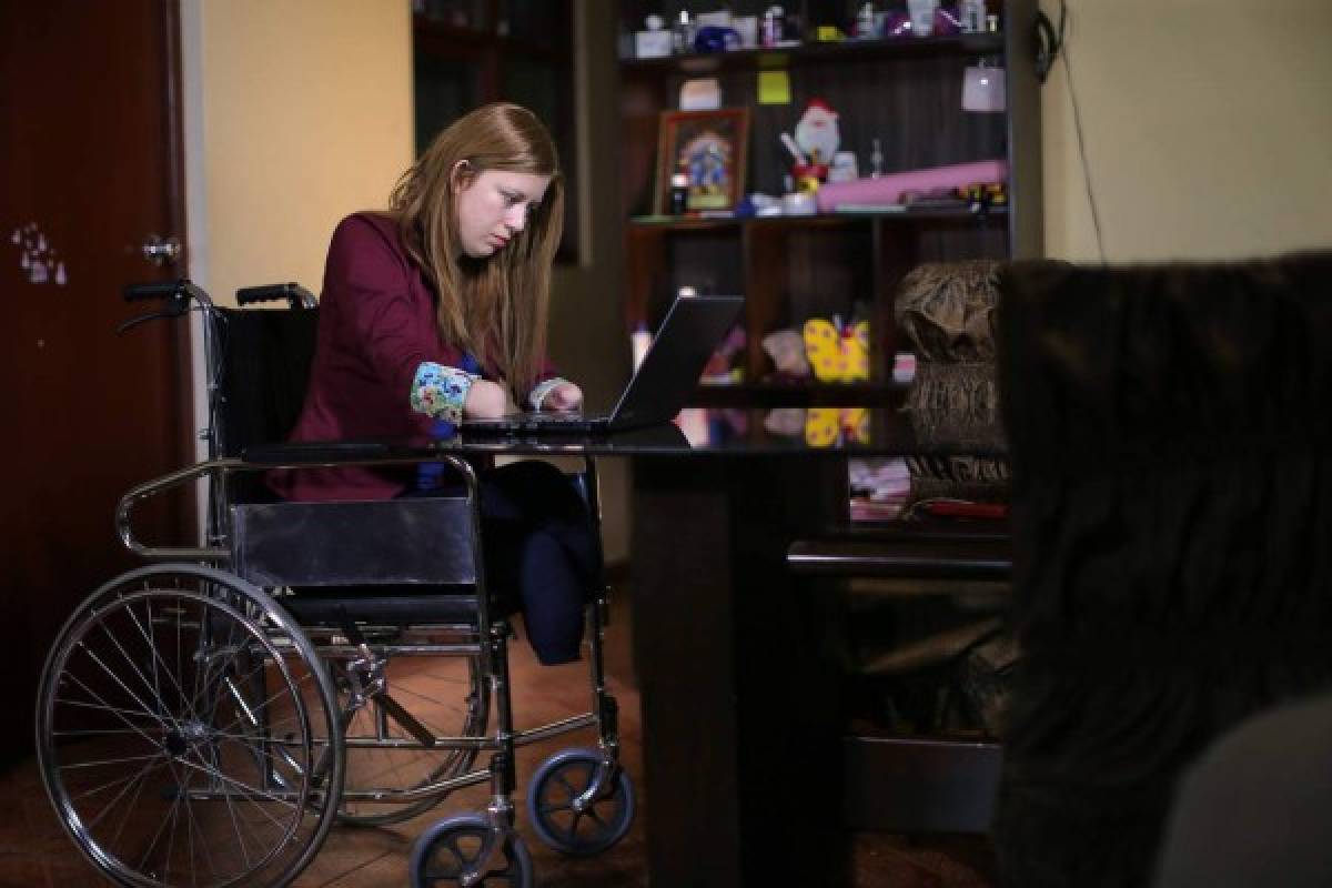 El testimonio de Shirley, la peruana que perdió brazos y piernas por negligencia médica